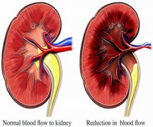 hypertension blood stream strain not to mention br essay hypertension maintain tension and br essay